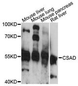CSAD / CSD Antibody - Western blot analysis of extracts of various cell lines, using CSAD antibody at 1:3000 dilution. The secondary antibody used was an HRP Goat Anti-Rabbit IgG (H+L) at 1:10000 dilution. Lysates were loaded 25ug per lane and 3% nonfat dry milk in TBST was used for blocking. An ECL Kit was used for detection and the exposure time was 30s.