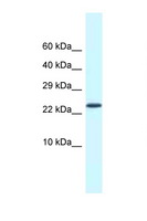 CSDC2 Antibody - CSDC2 antibody Western blot of Mouse Heart lysate. Antibody concentration 1 ug/ml.  This image was taken for the unconjugated form of this product. Other forms have not been tested.