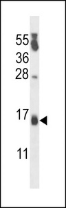 CSDC2 Antibody - PIPPIN Antibody western blot of MDA-MB231 cell line lysates (35 ug/lane). The PIPPIN antibody detected the PIPPIN protein (arrow).