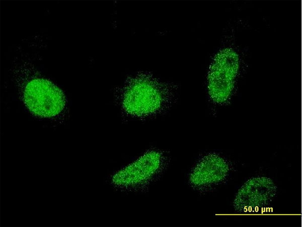 CSDC2 Antibody - Immunofluorescence of monoclonal antibody to CSDC2 on HeLa cell (antibody concentration 10 ug/ml).