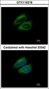 CSDE1 Antibody - Immunofluorescence of methanol-fixed HeLa using CSDE1 antibody at 1:200 dilution.