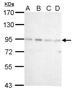 CSDE1 Antibody - CSDE1 antibody [N2C1], Internal detects CSDE1 protein by Western blot analysis. A. 30 ug 293T whole cell lysate/extract. B. 30 ug A431 whole cell lysate/extract. C. 30 ug HeLa whole cell lysate/extract. D. 30 ug A375 whole cell lysate/extract. 7.5 % SDS-PAGE. CSDE1 antibody [N2C1], Internal dilution:1:1000