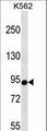 CSDE1 Antibody - CSDE1 Antibody western blot of K562 cell line lysates (35 ug/lane). The CSDE1 antibody detected the CSDE1 protein (arrow).