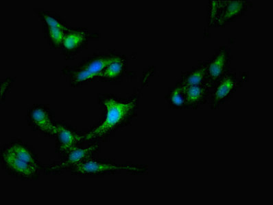 CSDE1 Antibody - Immunofluorescent analysis of Hela cells using CSDE1 Antibody at dilution of 1:100 and Alexa Fluor 488-congugated AffiniPure Goat Anti-Rabbit IgG(H+L)