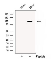 CSDE1 Antibody - Western blot analysis of extracts of HeLa cells using CSDE1 antibody. The lane on the left was treated with blocking peptide.