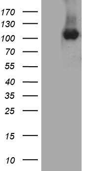 CSE1L Antibody - HEK293T cells were transfected with the pCMV6-ENTRY control. (Left lane) or pCMV6-ENTRY CSE1L. (Right lane) cDNA for 48 hrs and lysed