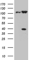 CSE1L Antibody - HEK293T cells were transfected with the pCMV6-ENTRY control. (Left lane) or pCMV6-ENTRY CSE1L. (Right lane) cDNA for 48 hrs and lysed