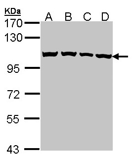CSE1L Antibody - Sample (30 ug of whole cell lysate). A:293T, B: A431 , C: H1299, D: Hela. 7.5% SDS PAGE. CSE1L antibody diluted at 1:1000.