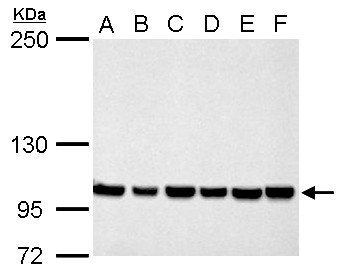CSE1L Antibody - CSE1L antibody detects CSE1L protein by Western blot analysis. A. 30 ug Neuro2A whole cell lysate/extract. B. 30 ug GL261 whole cell lysate/extract. C. 30 ug C8D30 whole cell lysate/extract. D. 30 ug NIH-3T3 whole cell lysate/extract. E. 30 ug BCL-1 whole cell lysate/extract. F. 30 ug Raw264.7 whole cell lysate/extract. G. 30 ug C2C12 whole cell lysate/extract. 5 % SDS-PAGE. CSE1L antibody dilution:1:1000