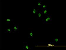 CSE1L Antibody - Immunofluorescence of monoclonal antibody to CSE1L on HeLa cell (antibody concentration 10 ug/ml).