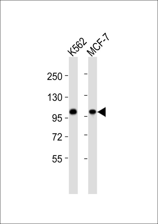 CSE1L Antibody - All lanes : Anti-XPO2 Antibody at 1:1000 dilution Lane 1: K562 whole cell lysates Lane 2: MCF-7 whole cell lysates Lysates/proteins at 20 ug per lane. Secondary Goat Anti-Rabbit IgG, (H+L),Peroxidase conjugated at 1/10000 dilution Predicted band size : 110 kDa Blocking/Dilution buffer: 5% NFDM/TBST.