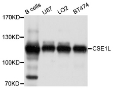 CSE1L Antibody - Western blot analysis of extracts of various cell lines.