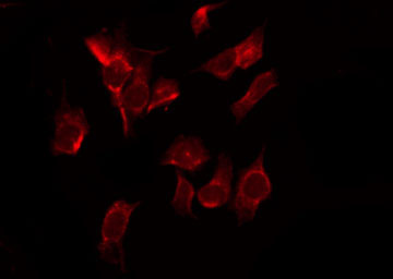 CSE1L Antibody - Staining 293 cells by IF/ICC. The samples were fixed with PFA and permeabilized in 0.1% Triton X-100, then blocked in 10% serum for 45 min at 25°C. The primary antibody was diluted at 1:200 and incubated with the sample for 1 hour at 37°C. An Alexa Fluor 594 conjugated goat anti-rabbit IgG (H+L) Ab, diluted at 1/600, was used as the secondary antibody.