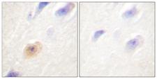 CSE1L Antibody - Peptide - + Immunohistochemical analysis of paraffin-embedded human brain tissue using CSE1 antibody.