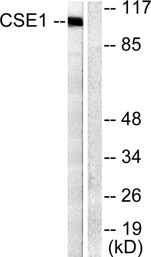 CSE1L Antibody - Western blot analysis of extracts from 293 cells, using CSE1 antibody.