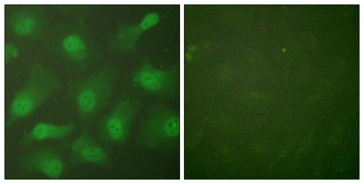 CSE1L Antibody - Forskolin + - Immunofluorescence analysis of HeLa cells, treated with Forskolin (40nM, 30mins), using CSE1 antibody.