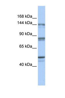 CSE1L Antibody - CSE1L antibody Western blot of Fetal Brain lysate. Antibody concentration 1 ug/ml. This image was taken for the unconjugated form of this product. Other forms have not been tested.
