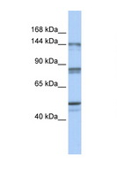 CSE1L Antibody - CSE1L antibody Western blot of Fetal Brain lysate. Antibody concentration 1 ug/ml. This image was taken for the unconjugated form of this product. Other forms have not been tested.