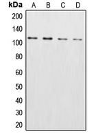 CSE1L Antibody - Western blot analysis of XPO2 expression in HeLa (A); NIH3T3 (B); SP2/0 (C); PC12 (D) whole cell lysates.