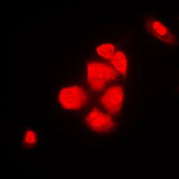 CSE1L Antibody - Immunofluorescent analysis of XPO2 staining in NIH3T3 cells. Formalin-fixed cells were permeabilized with 0.1% Triton X-100 in TBS for 5-10 minutes and blocked with 3% BSA-PBS for 30 minutes at room temperature. Cells were probed with the primary antibody in 3% BSA-PBS and incubated overnight at 4 C in a humidified chamber. Cells were washed with PBST and incubated with a DyLight 594-conjugated secondary antibody (red) in PBS at room temperature in the dark. DAPI was used to stain the cell nuclei (blue).