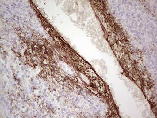 CSF1 / MCSF Antibody - Immunohistochemical staining of paraffin-embedded Human tonsil within the normal limits using anti-CSF1 mouse monoclonal antibody. (Heat-induced epitope retrieval by 1 mM EDTA in 10mM Tris, pH8.5, 120C for 3min,