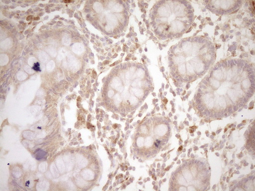 CSF1 / MCSF Antibody - Immunohistochemical staining of paraffin-embedded Human colon tissue within the normal limits using anti-CSF1 mouse monoclonal antibody. (Heat-induced epitope retrieval by 1 mM EDTA in 10mM Tris, pH8.5, 120C for 3min,