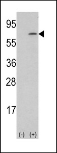 CSF1 / MCSF Antibody - Western blot of lysate from human placenta tissue lysate, using M-CSF Antibody. Antibody was diluted at 1:1000 at each lane. A goat anti-rabbit IgG H&L (HRP) at 1:5000 dilution was used as the secondary antibody. Lysate at 35ug per lane.