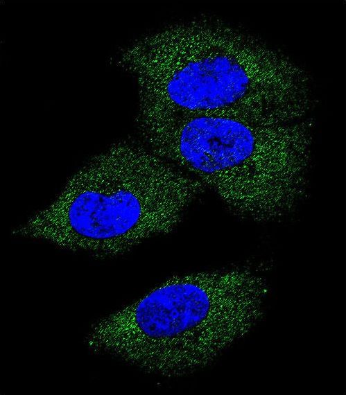 CSF1 / MCSF Antibody - Confocal immunofluorescence of M-CSF Antibody with MDA-MB231 cell followed by Alexa Fluor 488-conjugated goat anti-rabbit lgG (green). DAPI was used to stain the cell nuclear (blue).