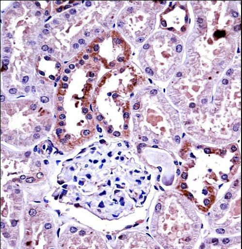 CSF1 / MCSF Antibody - M-CSF Antibody immunohistochemistry of formalin-fixed and paraffin-embedded human kidney tissue followed by peroxidase-conjugated secondary antibody and DAB staining.
