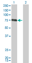CSF1 / MCSF Antibody - Western Blot analysis of CSF1 expression in transfected 293T cell line by CSF1 monoclonal antibody (M01), clone 1A9.Lane 1: CSF1 transfected lysate(60.1 KDa).Lane 2: Non-transfected lysate.