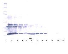CSF1 / MCSF Antibody - Western Blot (reducing) of CSF1 / M-CSF antibody. This image was taken for the unconjugated form of this product. Other forms have not been tested.