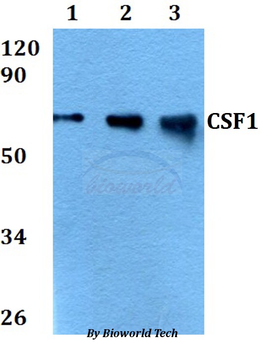 CSF1 / MCSF Antibody - Western blot of CSF1 antibody at 1:500 dilution. Lane 1: A549 whole cell lysate. Lane 2: sp2/0 whole cell lysate. Lane 3: PC12 whole cell lysate.