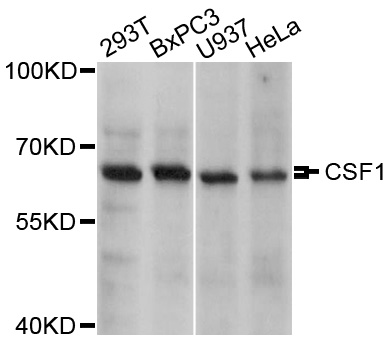 CSF1 / MCSF Antibody - Western blot analysis of extracts of various cell lines, using CSF1 antibody at 1:1000 dilution. The secondary antibody used was an HRP Goat Anti-Rabbit IgG (H+L) at 1:10000 dilution. Lysates were loaded 25ug per lane and 3% nonfat dry milk in TBST was used for blocking. An ECL Kit was used for detection and the exposure time was 5s.