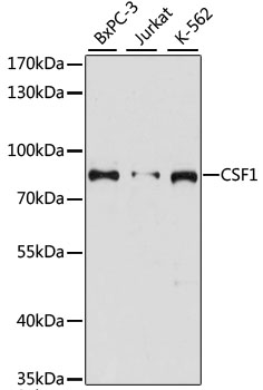 CSF1 / MCSF Antibody - Western blot analysis of extracts of various cell lines, using CSF1 antibody at 1:3000 dilution. The secondary antibody used was an HRP Goat Anti-Rabbit IgG (H+L) at 1:10000 dilution. Lysates were loaded 25ug per lane and 3% nonfat dry milk in TBST was used for blocking. An ECL Kit was used for detection and the exposure time was 90s.
