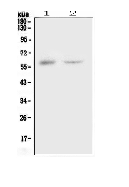 CSF1 / MCSF Antibody - Western blot analysis of CSF1 using anti-CSF1 antibody. Electrophoresis was performed on a 5-20% SDS-PAGE gel at 70V (Stacking gel) / 90V (Resolving gel) for 2-3 hours. The sample well of each lane was loaded with 50ug of sample under reducing conditions. Lane 1: human placenta tissue lysates,Lane 2: human 293T whole cell lysate. After Electrophoresis, proteins were transferred to a Nitrocellulose membrane at 150mA for 50-90 minutes. Blocked the membrane with 5% Non-fat Milk/ TBS for 1.5 hour at RT. The membrane was incubated with rabbit anti-CSF1 antigen affinity purified polyclonal antibody at 0.5 µg/mL overnight at 4°C, then washed with TBS-0.1% Tween 3 times with 5 minutes each and probed with a goat anti-rabbit IgG-HRP secondary antibody at a dilution of 1:10000 for 1.5 hour at RT. The signal is developed using an Enhanced Chemiluminescent detection (ECL) kit with Tanon 5200 system. A specific band was detected for CSF1 at approximately 60KD. The expected band size for CSF1 is at 60KD.