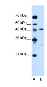 CSF1 / MCSF Antibody - CSF1 / MCSF antibody ARP44329_P050-NP_757349-CSF1(colony stimulating factor 1 (macrophage)) Antibody Western blot of Jurkat lysate.  This image was taken for the unconjugated form of this product. Other forms have not been tested.