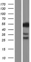 CSF1 / MCSF Protein - Western validation with an anti-DDK antibody * L: Control HEK293 lysate R: Over-expression lysate