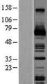 CSF1 / MCSF Protein - Western validation with an anti-DDK antibody * L: Control HEK293 lysate R: Over-expression lysate