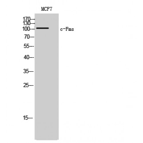 CSF1R / CD115 / FMS Antibody - Western blot of c-Fms antibody