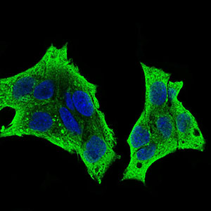 CSF1R / CD115 / FMS Antibody - Immunofluorescence of HepG2 cells using CSF1R mouse monoclonal antibody (green). Blue: DRAQ5 fluorescent DNA dye. Secondary antibody from Fisher (Cat#: 35503)