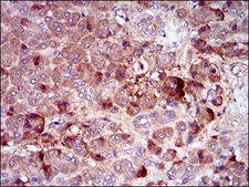 CSF1R / CD115 / FMS Antibody - IHC of paraffin-embedded pancreas tissues using CSF1R mouse monoclonal antibody with DAB staining.