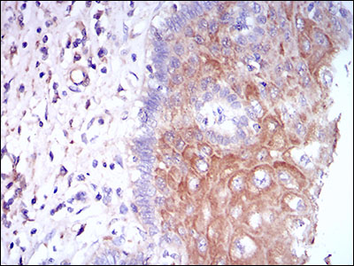 CSF1R / CD115 / FMS Antibody - IHC of paraffin-embedded esophageal tissues using CSF1R mouse monoclonal antibody with DAB staining.