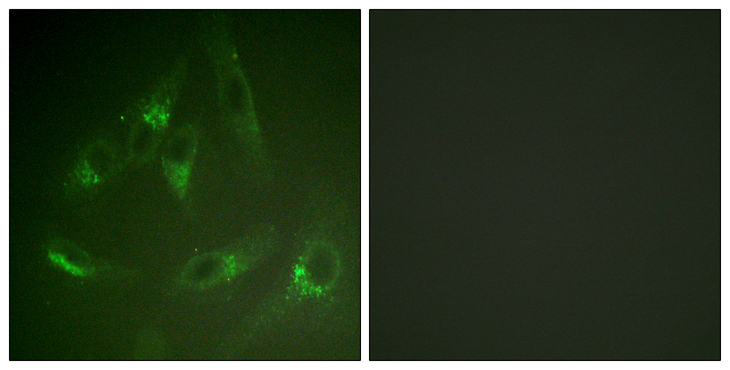 CSF1R / CD115 / FMS Antibody - Immunofluorescence analysis of HeLa cells, using CSFR Antibody. The picture on the right is blocked with the synthesized peptide.