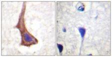 CSF1R / CD115 / FMS Antibody - Immunohistochemistry analysis of paraffin-embedded human brain tissue, using CSFR Antibody. The picture on the right is blocked with the synthesized peptide.
