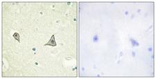 CSF1R / CD115 / FMS Antibody - Immunohistochemistry analysis of paraffin-embedded human brain tissue, using M-CSF Receptor Antibody. The picture on the right is blocked with the synthesized peptide.