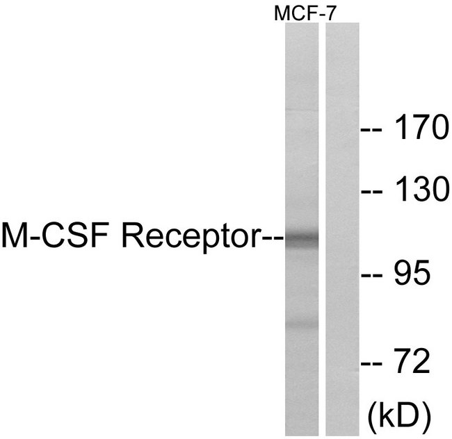 CSF1R / CD115 / FMS Antibody - Western blot analysis of lysates from MCF7 cells, using M-CSF Receptor Antibody. The lane on the right is blocked with the synthesized peptide.