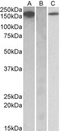 CSF1R / CD115 / FMS Antibody - HEK293 lysate (10ug protein in RIPA buffer) overexpressing Human CSF1R with C-terminal MYC tag probed with (1ug/ml) in Lane A and probed with anti-MYC Tag (1/1000) in lane C. Mock-transfected HEK293 probed (1mg/ml) in Lane B. Primary
