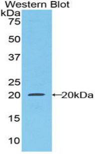 CSF1R / CD115 / FMS Antibody - Western blot of recombinant CSF1R / CD115 / FMS.  This image was taken for the unconjugated form of this product. Other forms have not been tested.