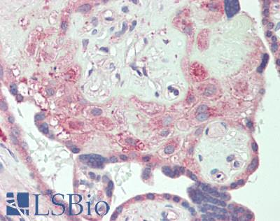 CSF1R / CD115 / FMS Antibody - Human Placenta: Formalin-Fixed, Paraffin-Embedded (FFPE)