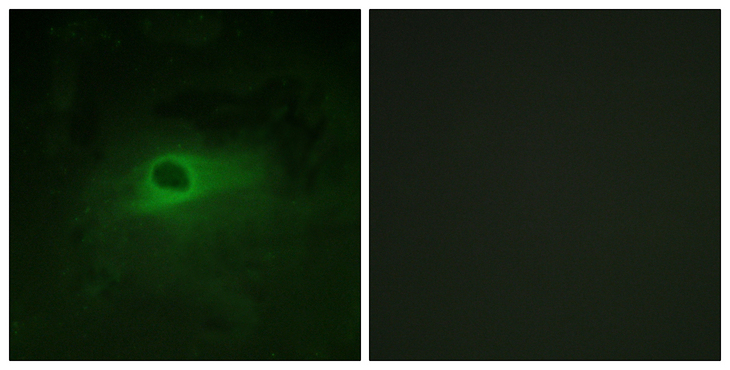 CSF1R / CD115 / FMS Antibody - Immunofluorescence analysis of HeLa cells, using CSFR Antibody. The picture on the right is blocked with the synthesized peptide.